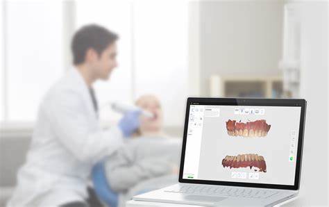 Threeshape Intra Oral Scanner